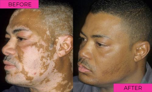 before-after-1