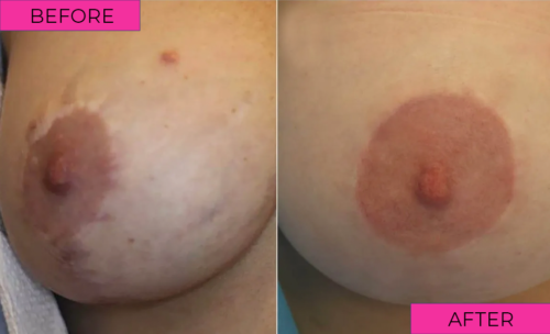 before-after-3