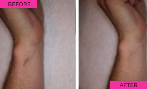 before-after-4