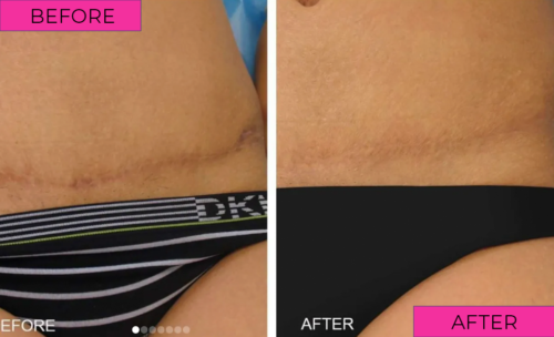 before-after-5